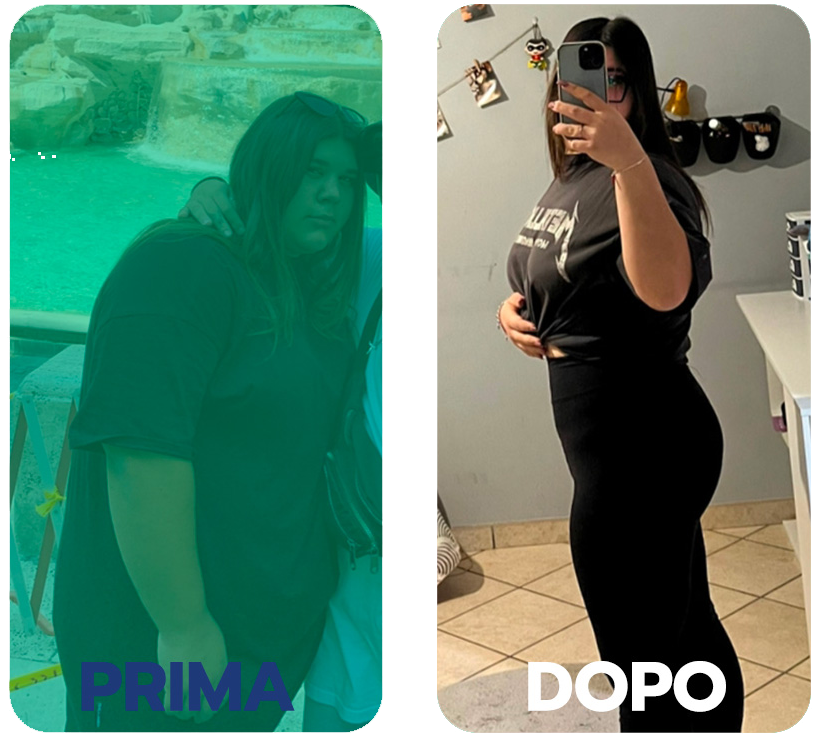prima-dopo-1