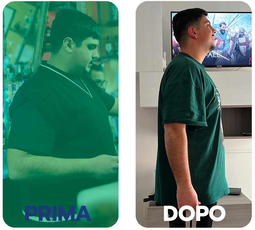 prima-dopo-2